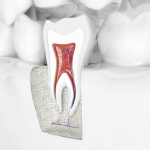 Endodontie (Wurzelkanalbehandlung) dentilus