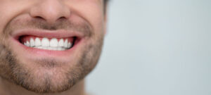 5 Tipps für gesundes Zahnfleisch