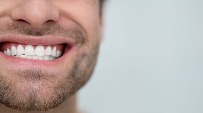 5 Tipps für gesundes Zahnfleisch