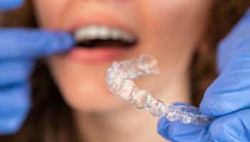 Invisalign Behandlung | Dentilus News
