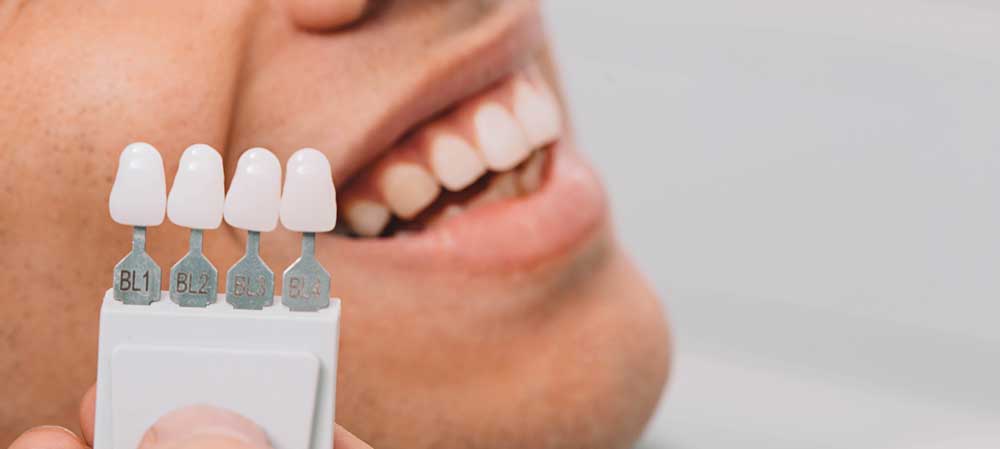 Zahnverfärbungen entfernen: Ursachen & Lösungen | Dentilus Zahnverfärbungen entfernen: Ursachen & Lösungen | Dentilus